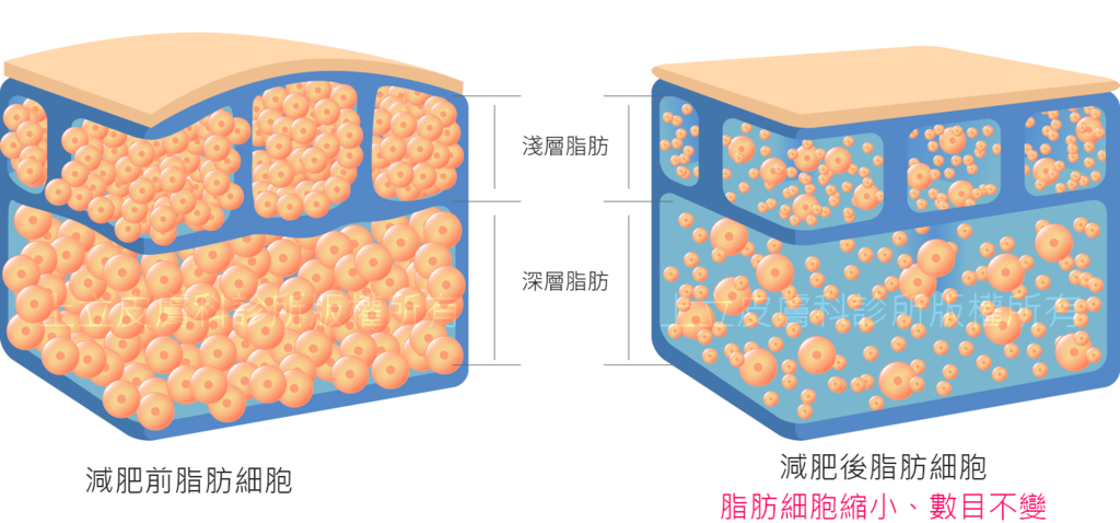 MICOOL-S冷凍溶脂效果冷凍溶脂價錢冷凍減脂心得冷凍溶脂推薦冷凍溶脂ptt冷凍溶脂原理冷凍溶脂術後瘦肚子的方法快速瘦肚子運動瘦肚子按摩快速瘦小腹運動瘦肚子飲食瘦肚子１２.png