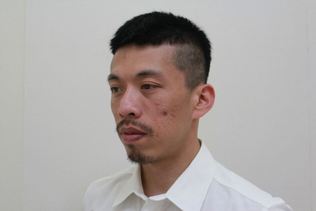 PicoSure755皮秒雷射蜂巢式聚焦陣列透鏡蜂巢透鏡皮秒雷射蜂巢皮秒雷射雀斑曬斑除斑痘疤毛孔細紋黑色素好膚質復原755蜂巢皮秒多久打一次蜂巢皮秒多少錢皮秒雷射價格755皮秒雷射價位04.JPG PicoSure755皮秒雷射蜂巢式聚焦陣列透鏡蜂巢透鏡皮秒雷射蜂巢皮秒雷射雀斑曬斑除斑痘疤毛孔細紋黑色素好膚質復原755蜂巢皮秒多久打一次蜂巢皮秒多少錢皮秒雷射價格755皮秒雷射價位04.JPG