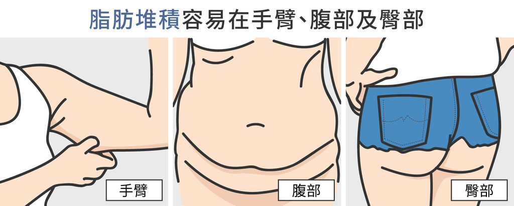 冷凍溶脂冷凍減脂MICOOL-S冷凍溶脂非侵入式體雕瘦身瘦肚子林上立醫生林上立醫師上立皮膚科診所瘦肚子冷凍減脂MICOOL-S台北哪裡做02.jpg