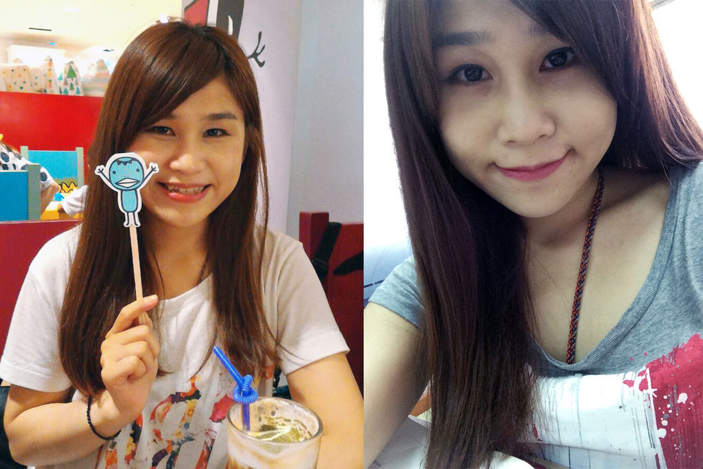 PicoSure755皮秒雷射蜂巢式聚焦陣列透鏡蜂巢透鏡皮秒雷射蜂巢皮秒雷射雀斑曬斑除斑痘疤毛孔細紋上立皮膚科診所林上立醫師9.jpg PicoSure755皮秒雷射蜂巢式聚焦陣列透鏡蜂巢透鏡皮秒雷射蜂巢皮秒雷射雀斑曬斑除斑痘疤毛孔細紋上立皮膚科診所林上立醫師9.jpg