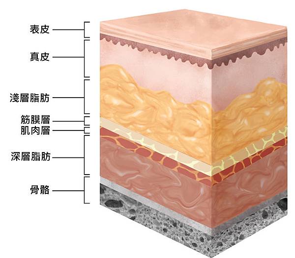 液態拉皮上立提二代童顏針膠原蛋白增生洢蓮絲費用價格術後保養1CC二代童顏針3D聚左旋乳酸手術拉皮7.jpg