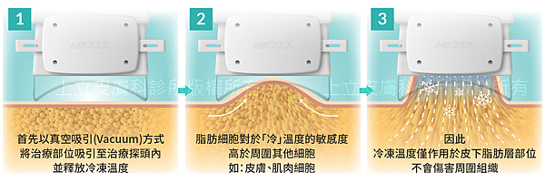 PicoSure755皮秒雷射蜂巢式聚焦陣列透鏡蜂巢透鏡痘疤凹疤飛梭雷射皮秒雷射價格價錢術後保養副作用除斑凹洞林上立上立皮膚科診所手術拉皮台北醫美推薦結痂05.png