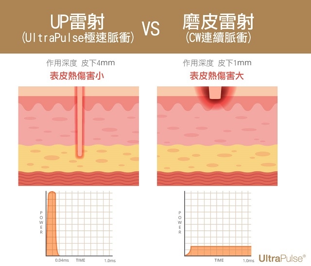 Up雷射ultrapulse汽化雷射雷射效果痘疤凹疤光老化痘疤治療副作用費用價錢痘疤保養效果凸疤深層痘疤up雷射永和皮膚科up雷射恢復期up雷射台北痘疤困擾術後保養up雷射要打幾次一次多少錢up雷射痘疤ppt林上立醫師上立皮膚科