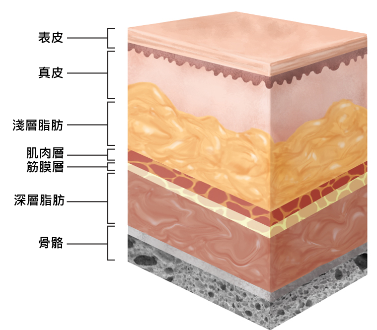 液態拉皮上立提立提少女線費用舒顏萃sculptra3D聚左旋乳酸洢蓮絲ellanse聚己內酯PicoSure755蜂巢皮秒雷射除斑痘疤毛孔細紋PCL台北醫美推薦抗老林上立醫師上立皮膚科診所02.png