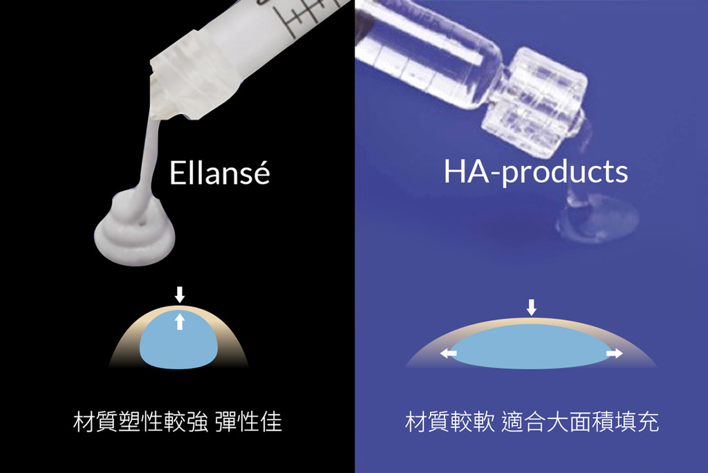 淚溝保養淚溝醫美淚溝推薦醫師玻尿酸淚溝費用玻尿酸淚溝維持淚溝改善眼袋淚溝醫美液態拉皮上立提洢蓮絲ellanse聚己內酯PCL依戀詩易麗適少女針4.jpg