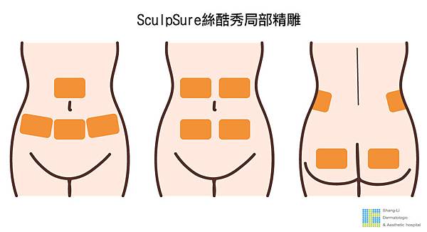 SculpSure體雕減肥減肥藥不好絲酷秀術後修復價格恢復期雷射體雕二極體冷凍溶脂減肥日記費用減肥食譜術後雷射溶脂局部平坦小腹塑身曲線雕塑林上立上立皮膚科診所04.jpg