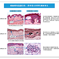 PicoSure755皮秒雷射蜂巢式雀斑曬斑除斑痘疤台北皮秒雷射推薦醫師皮膚科醫師痘疤凹疤飛梭雷射皮秒雷射價格副作用除斑凹洞淨膚雷射防曬推薦防曬乳曬黑紫外線4.png