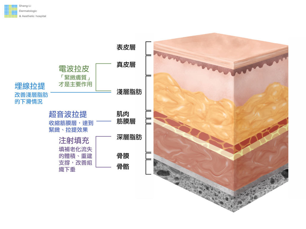 埋線拉提埋線拉提推薦埋線拉提價格埋線拉提效果埋線拉提維持多久 (4).jpg 埋線拉提埋線拉提推薦埋線拉提價格埋線拉提效果埋線拉提維持多久 (4).jpg