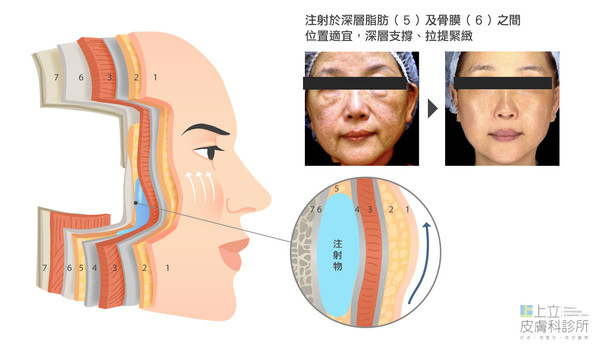 05-妳老了嗎？女性老化四大徵兆