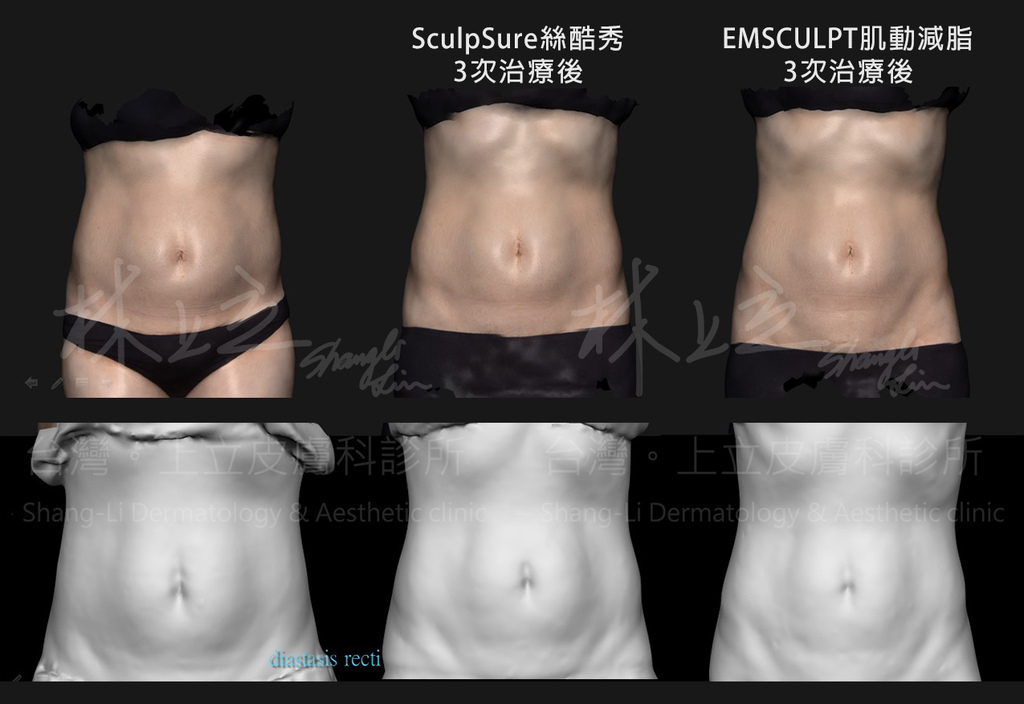 13-Body Sculpture-Comparison.jpg