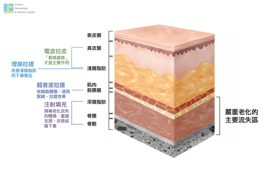 微整形抗老拉提療程電波拉皮埋線拉提舒顏萃洢蓮絲依戀詩愛麗斯液態拉皮上立提4.jpg