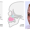 淚溝改善原因淚溝醫美玻尿酸玻尿酸淚溝維持舒顏萃洢蓮絲艾麗斯台北醫師推薦林上立醫師3.jpg