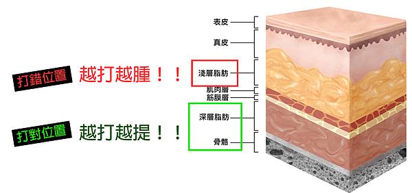 蘋果肌價錢蘋果肌凹陷下垂玻尿酸洢蓮絲舒顏萃膠原蛋白新生劑艾麗斯少女針精靈針林上立醫師推薦6.jpg