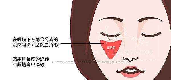 蘋果肌價錢蘋果肌凹陷下垂玻尿酸洢蓮絲舒顏萃膠原蛋白新生劑艾麗斯少女針精靈針林上立醫師推薦3.jpg