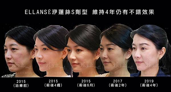 collagen-how-much-hyaluronic-acid-doctor-prove-it-to-you collagen-how-much-hyaluronic-acid-doctor-prove-it-to-you