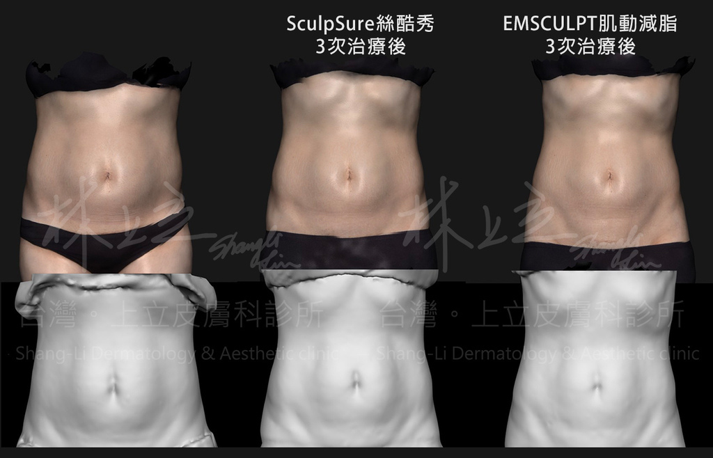 絲酷秀+EMSCULPT_修.jpg