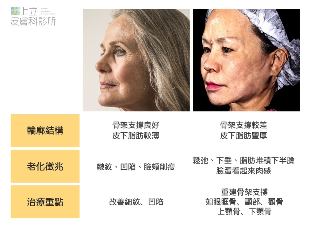 液態拉皮上立提洢蓮絲ellanse聚己內酯PCL少女針奇蹟針二代童顏針玻尿酸隆鼻林上立醫師9.jpg 液態拉皮上立提洢蓮絲ellanse聚己內酯PCL少女針奇蹟針二代童顏針玻尿酸隆鼻林上立醫師9.jpg