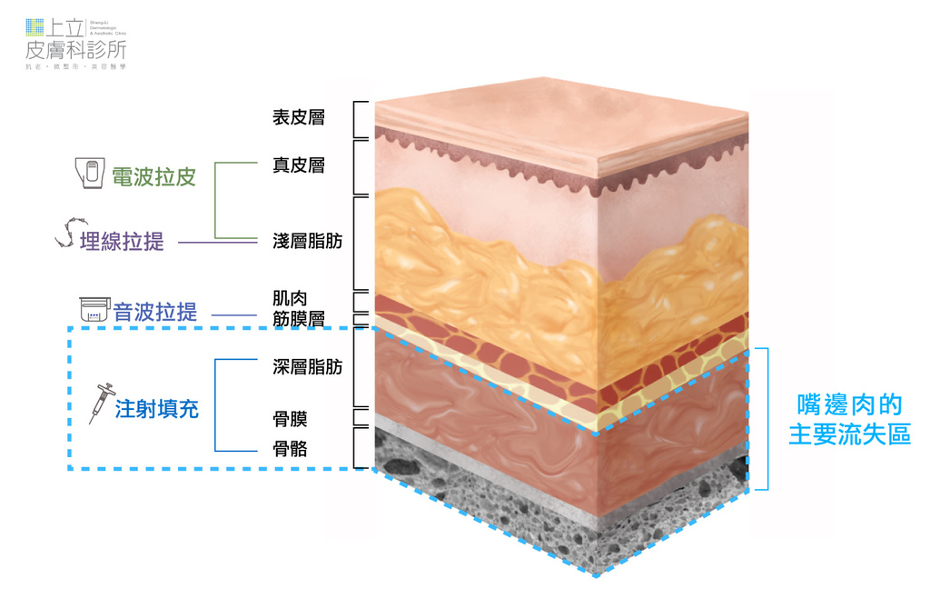 Spending-100,000-yuan-for-embedding-the meat-on-the-mouth-but-no-effect (7).jpg