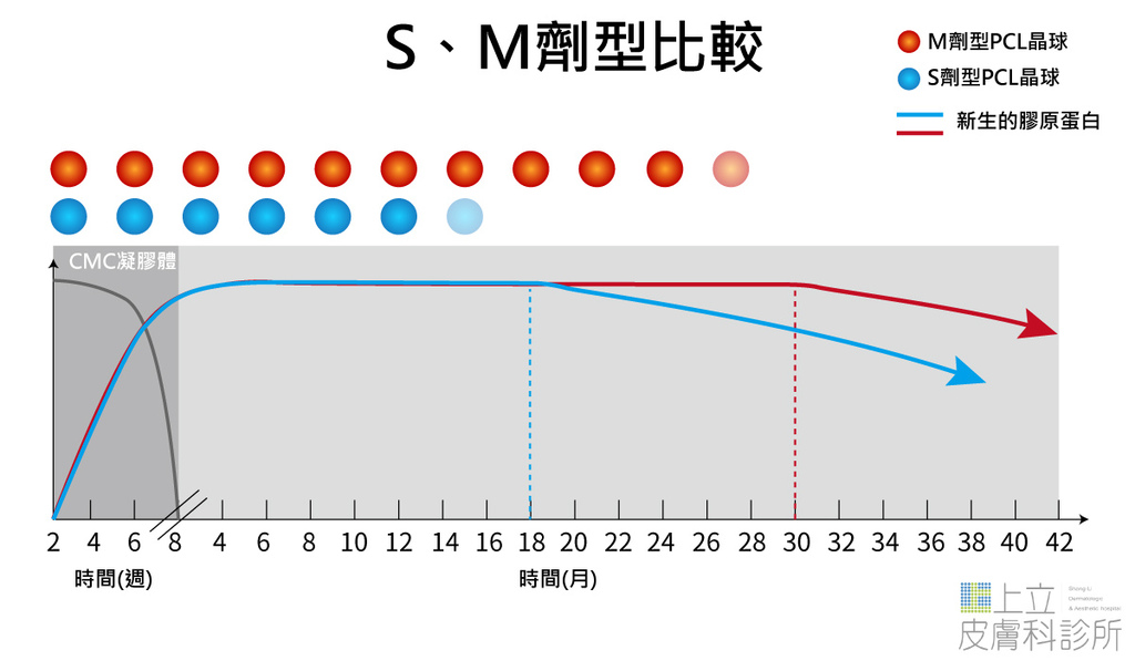 洢蓮絲、艾麗斯引發選擇困難？其實，你不一定要二選一