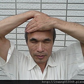 額頭頭頂 額頭頭頂