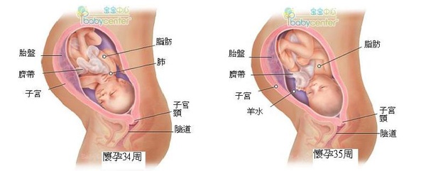 fetal34-35 index.JPG