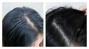 生髮9.jpeg 生髮9.jpeg