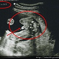 20 week Ultrasound - it's a boy.jpg