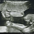 20 week Ultrasound - arms.jpg