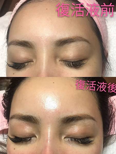 大小姐美容美體工作室_201118_14 復活液臉部保養前後