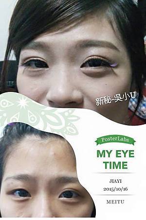 嘉義新娘祕書-眼型調整001 嘉義新娘祕書-眼型調整001