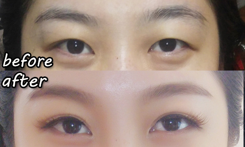 嘉義新秘吳小U-頤眼型調整.jpg 嘉義新秘吳小U-頤眼型調整.jpg