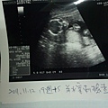 2011.11.12懷孕19週+5