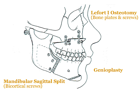 diagram-of-face