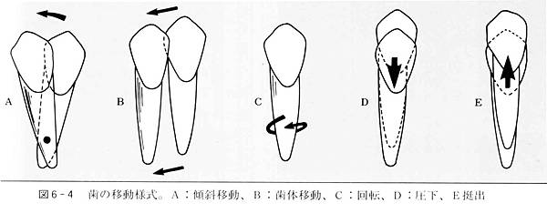 「牙齒矯正移動的形式」的圖片搜尋結果