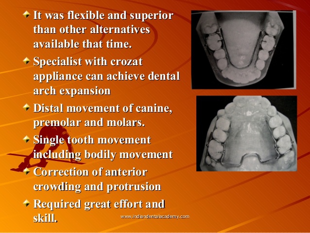 expansion-with-removable-orthodontic-appliance-certified-fixed-orthodontic-courses-by-indian-dental-academy-25-638.jpg