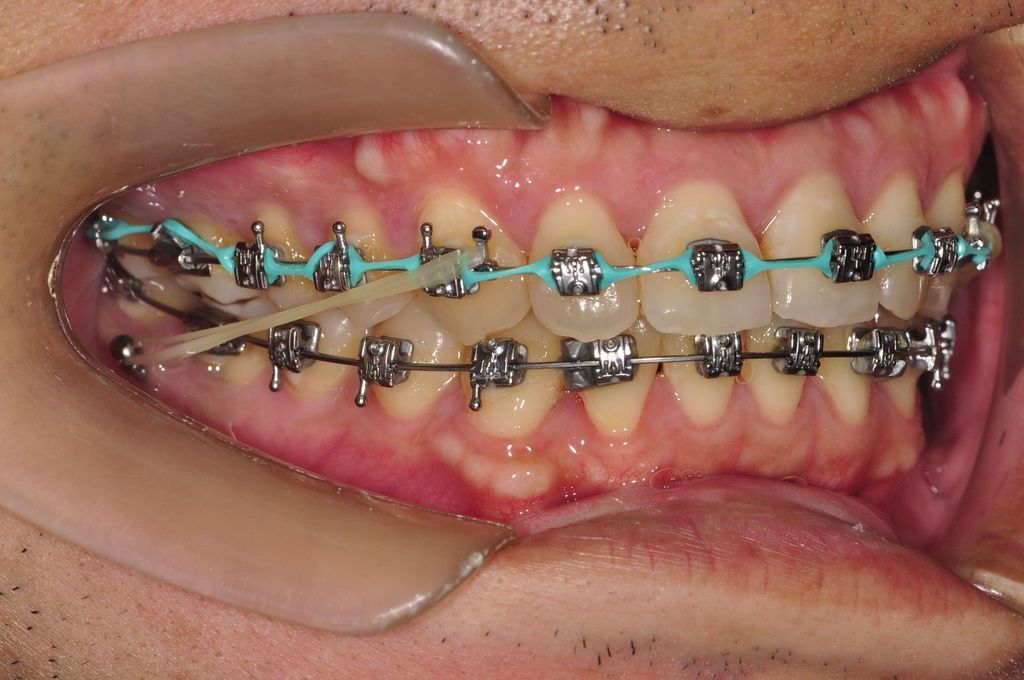 20151211 477.JPG 20151211 477.JPG