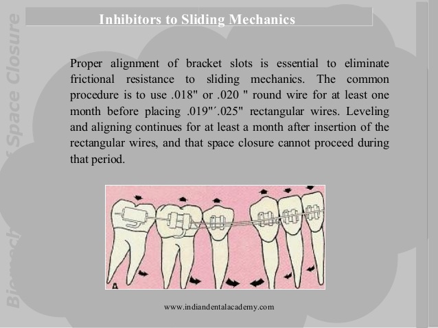 biomechanics-of-space-closure-in-orthodonticcs-fixed-orthodontics-courses-55-638.jpg