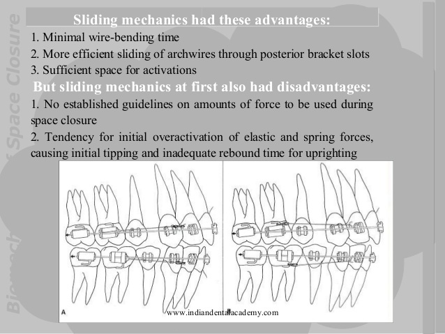 biomechanics-of-space-closure-in-orthodonticcs-fixed-orthodontics-courses-48-638.jpg