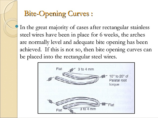 @齒顎矯正每日一說~~0154 curve of Spee(