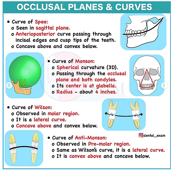 @齒顎矯正每日一說~~0154 curve of Spee(