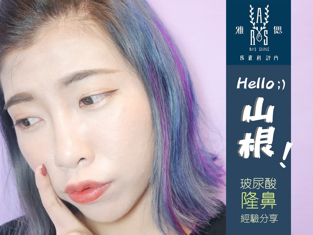 雅偲玻尿酸隆鼻.png 雅偲玻尿酸隆鼻.png