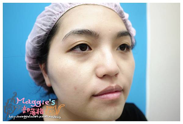 佳醫美人診所 (19).JPG