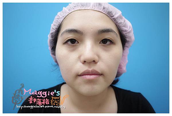 佳醫美人診所 (20).JPG