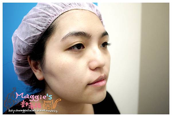 佳醫美人診所 (21).JPG