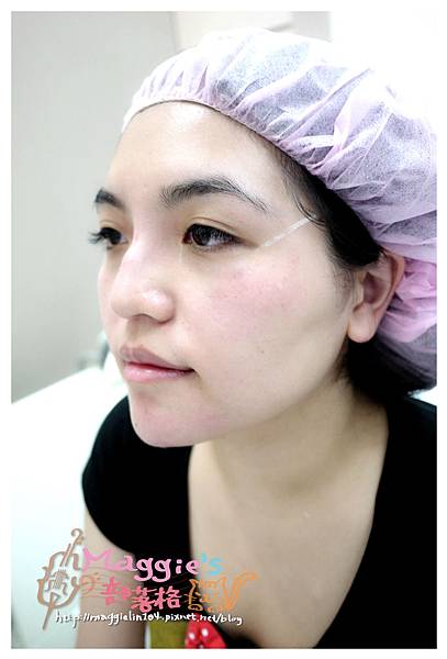 佳醫美人診所 (31).JPG