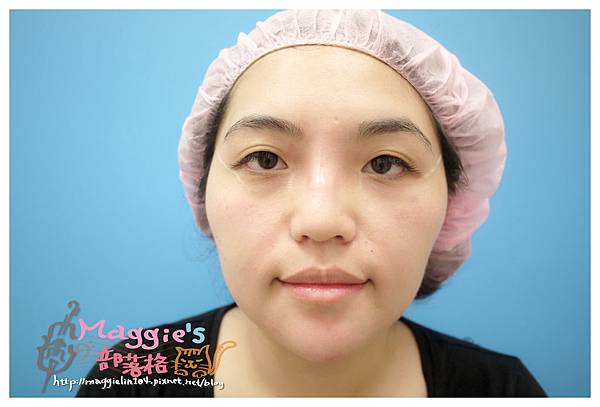 佳醫美人診所 (32).JPG