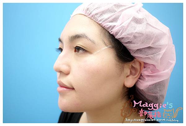 佳醫美人診所 (33).JPG