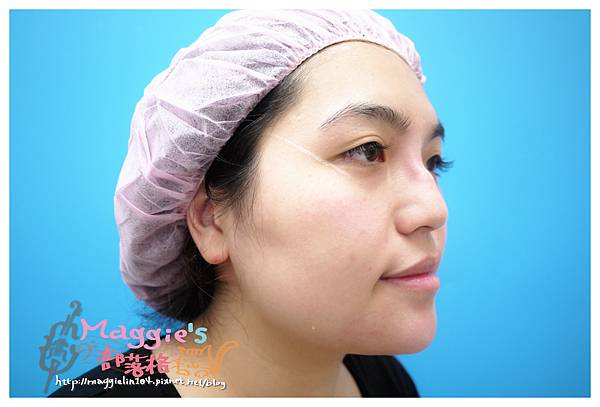 佳醫美人診所 (34).JPG