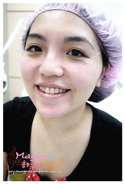 佳醫美人診所 (35).JPG