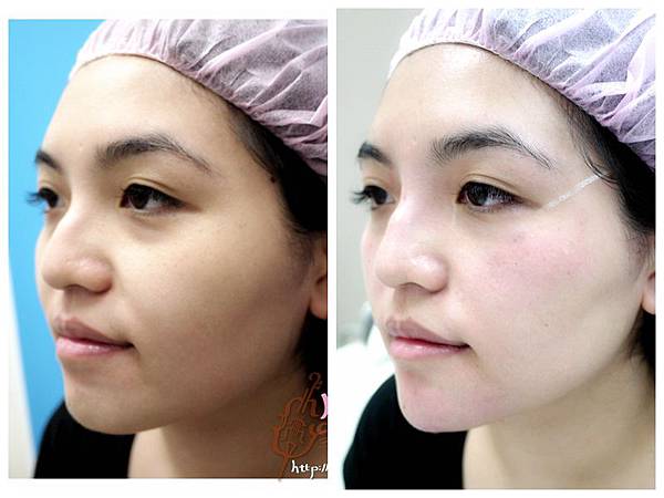 佳醫美人診所 (39)